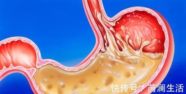 心塞|肝火旺盛,晚上容易失眠,教你2个方法,入睡快睡眠香