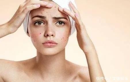 螨虫折腾你脸, 四个损害的会出现, 采用两招清走它! !