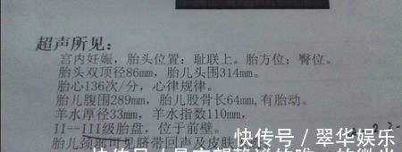 胎心监护|孕期说有这几个信号,腹中的胎儿,十有八九是个小千金