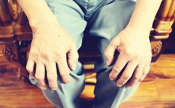 心源性水肿|老年人双腿、双脚浮肿,一定是得了疾病吗?真相来了