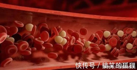 苦苣根|又被称为血管“清道夫”,每天吃一点,血管干净了,血栓消失了