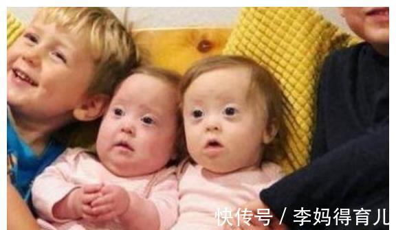 高龄产妇|怀孕期间若有4种情况之一,生出唐氏儿,希望你一个也没有