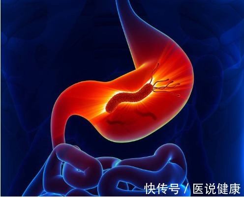 反复发作|胃溃疡反复发作,或与这5个因素有关,是时候了解一下了