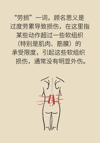 腰肌劳损|年纪轻轻也没干啥体力活儿,怎么就腰肌劳损了?