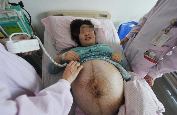 meimei|90后孕妇生下四胞胎,婆家兴高采烈抱孙子,娘家哭成泪人