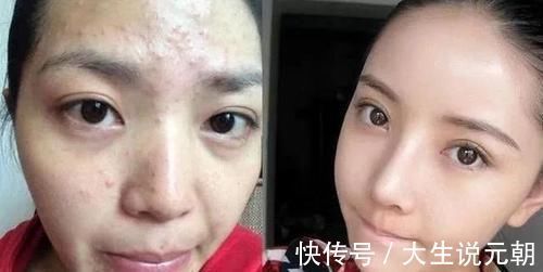 敏感肌|长期素颜和每天化妆的女人,坚持10年后,皮肤差异巨大