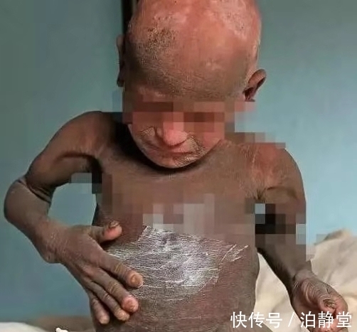 男孩|男孩越长越像“石孩”,去医院检查后,怒骂其父母丢人现眼!