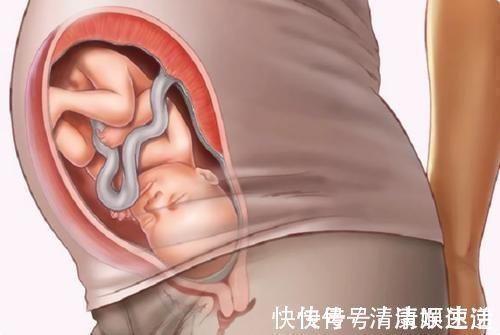 入盆|胎儿何时入盆?入盆啥信号?入盆啥时候卸货?准妈妈必知一文讲清
