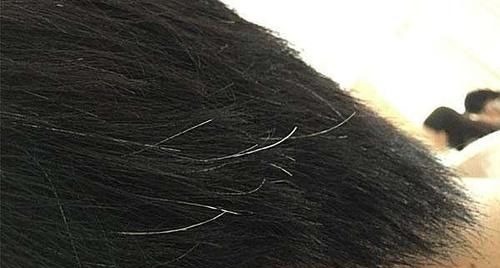 染发|长白头发的人,比正常人的患癌风险低,是真的吗医生告诉你答案