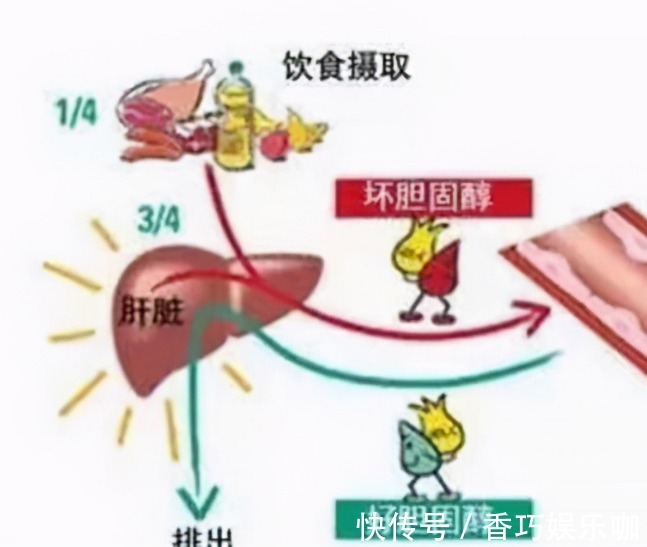 指标|腿是第二个心脏！胆固醇有没有超标？不要查血脂，腿上就有信号