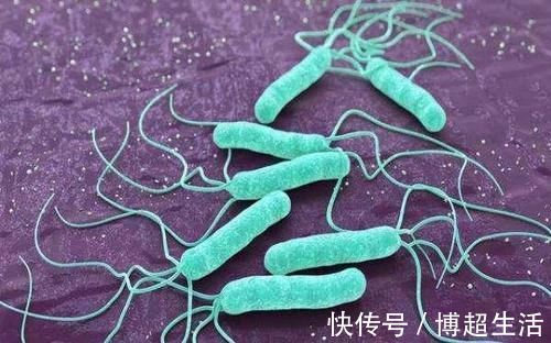 老王|男子查出肠癌,后来才知道:原来大便早就“预警”,自己没在意