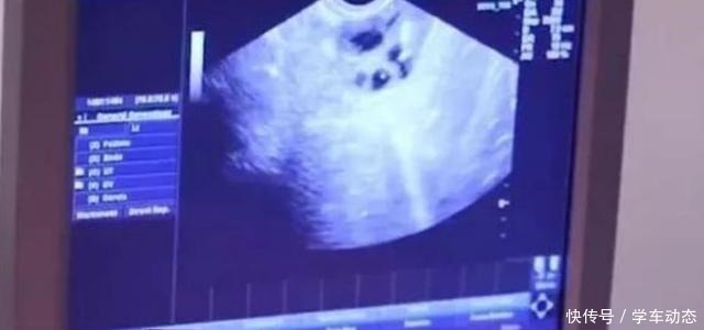 西瓜|“你是从西瓜里蹦出来的”砸50万生5国混血宝宝的妈妈如今怎样!