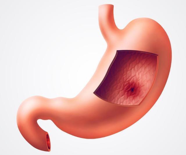 河洛精蕴|胃不好,多喝二水,少吃三菜,记住4个动作,胃炎轻易“不上门”