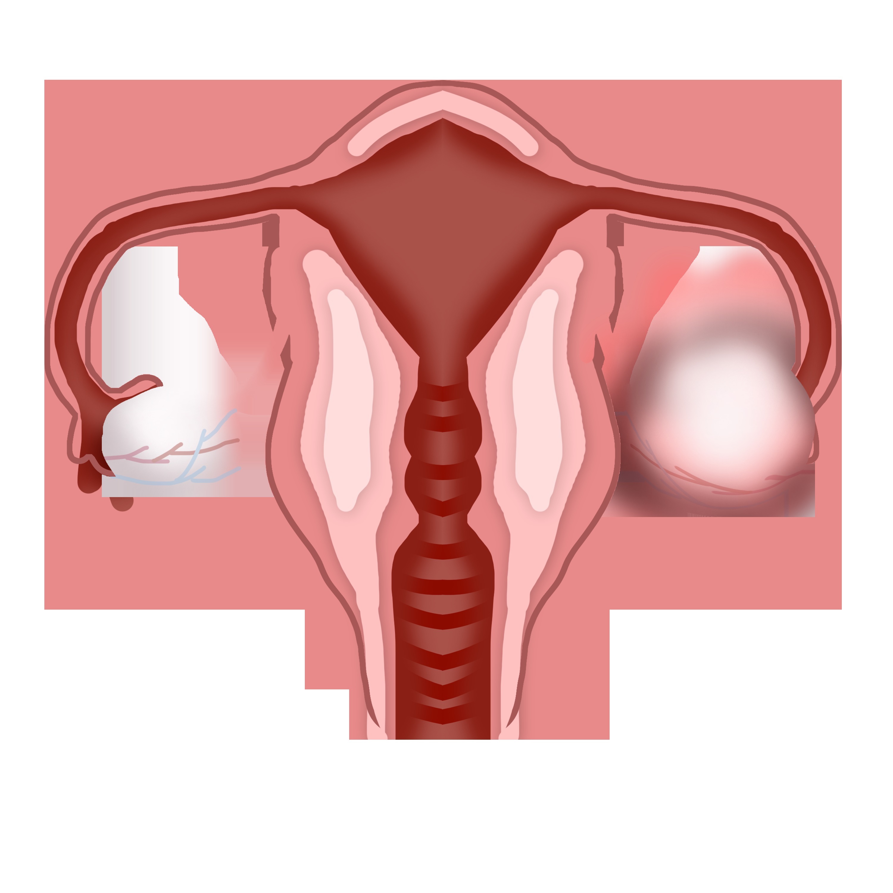 宝妈|产后肚子依然圆成球,可能不是胖,而是因为这个
