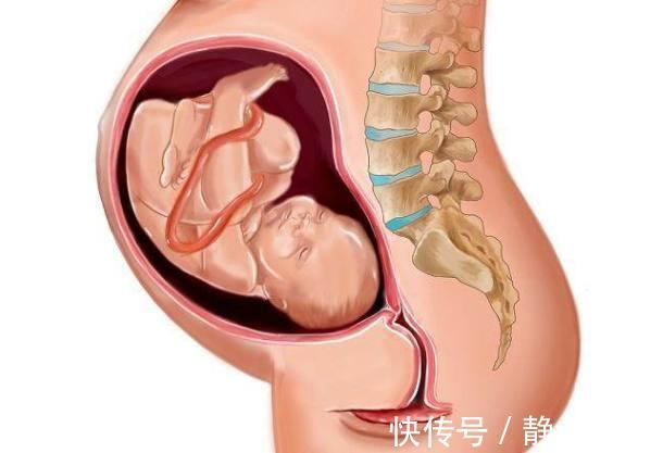 宝妈|有这四种条件的孕妈，生宝宝比较快，占两条就很幸运了