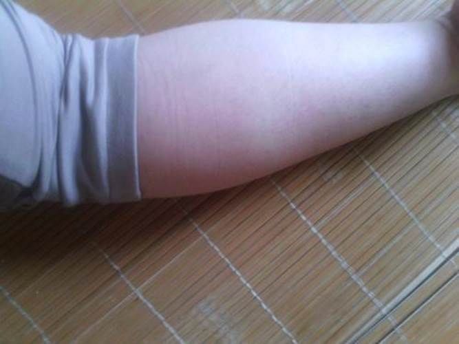 孩子|孩子过早开始3项运动,可能短时间内会长高,但长远看太吃亏了