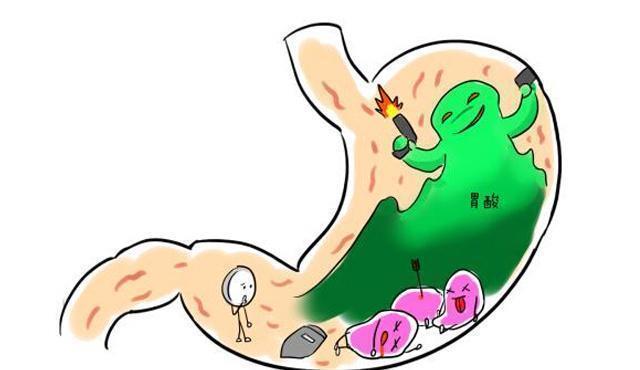 胃酸|胃痛、胃胀、反酸、嗳气、烧心还有溃疡,都有哪些药治?