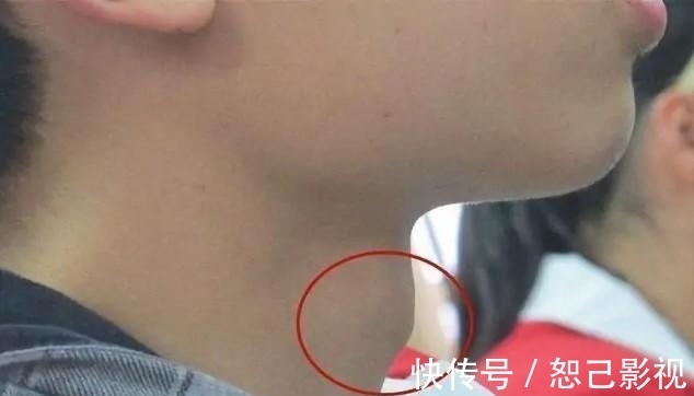 身高|12岁女孩身高145cm,医生:孩子若有两个特征,预示骨垢线要闭合