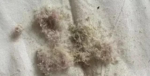 床上螨虫成窝,家里老人小孩老过敏,教你1个土法子,让螨虫消失