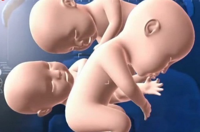 宝宝|孕妇怀四胞胎以为是儿子,结果生四个女儿,爸爸产房外手舞足蹈