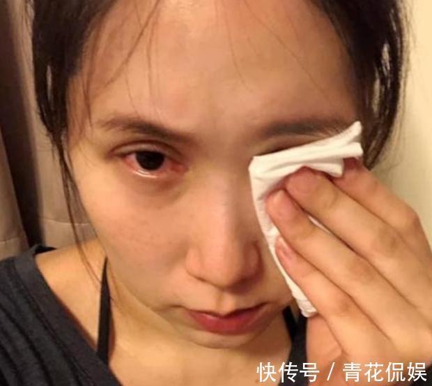 放弃|38岁女星余苑绮癌细胞已扩散,但为2个未成年孩子,坚称不会放弃