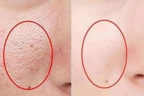 长期素颜和每天化妆的女人，坚持10年后，皮肤差异巨大