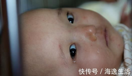 孩子|孩子烫伤,奶奶用“偏方”直接导致孩子休克,行不通的别硬来