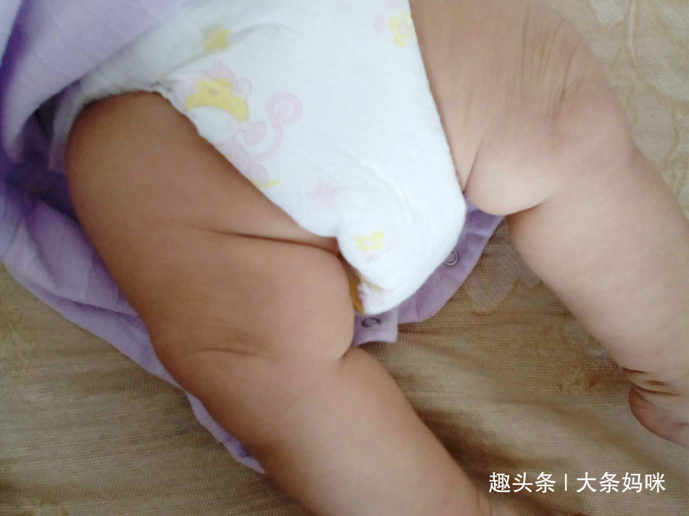 妈妈|腿部可以看出健康问题,宝宝双腿出现3种情况,妈妈不能小觑