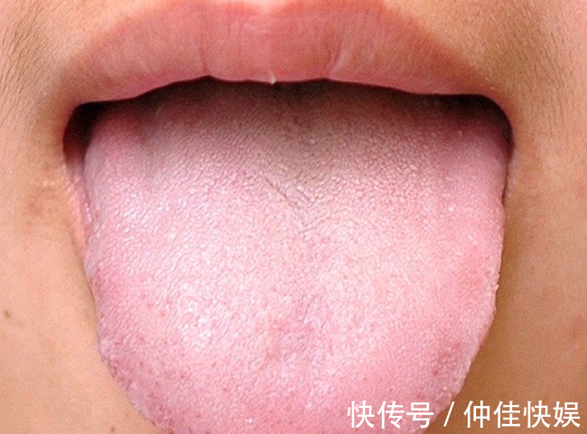 体质|舌是脏腑“本色反映”,8种体质,8种舌象,老中医教你怎么望舌