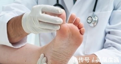 降糖|糖尿病人喝水时,抓点“它”放进去,或许降糖效果强过“胰岛素”