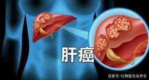肝不好的人，这2种蔬菜少吃，若常吃要养成这两个习惯，或对肝好