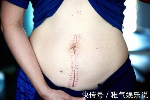 孕晚期|想要孕晚期安心待产？临产征兆、分娩饮食等知识需知道！