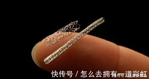 心脏病|心脏支架手术后，还可以活多久医生终于给出准确答案，早做准备