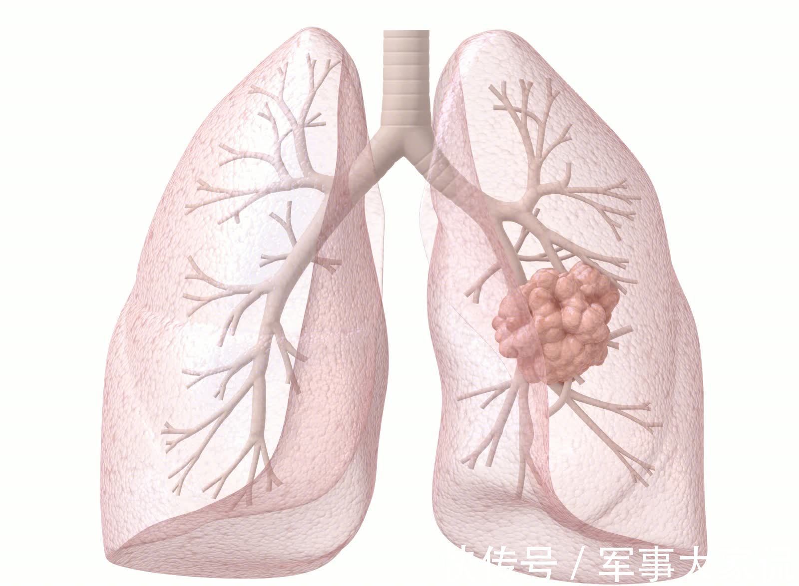 食物|肺病最怕4种食物，常吃离肺病远远的，肺好人精神