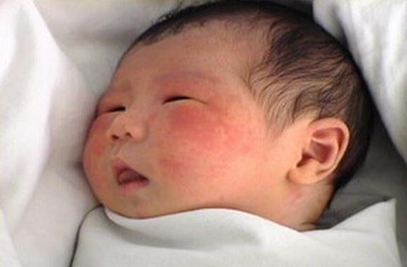 宝宝|孕晚期需要去“胎毒”吗孕妇做好5点,比吃鹅蛋要有效