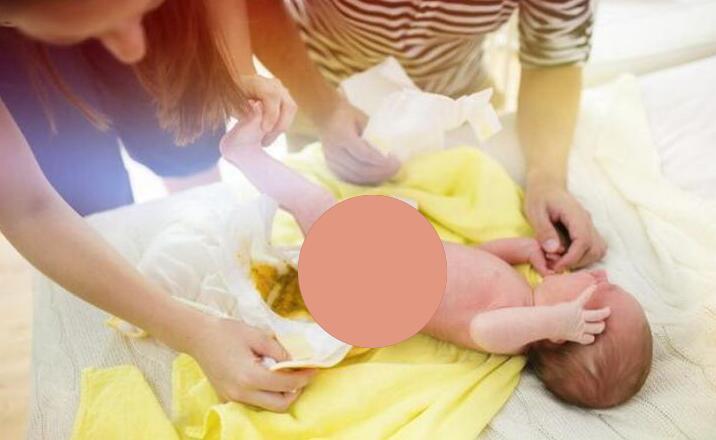 宝宝|便便是孩子健康的“晴雨表”,哪种健康哪种危险宝妈要心里有数