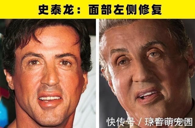 手术|大方承认自己做过整形手术的8名好莱坞明星