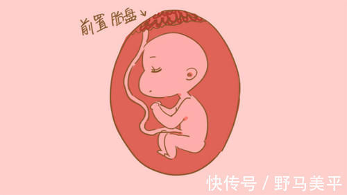 顺转剖|产妇难“顺”又改“剖”,早知道直接剖腹产!这个罪为啥要受?