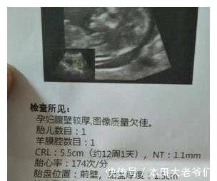 性别|孕期若有3种“情况”发生,别担心,是胎宝在暗示“性别”小秘密