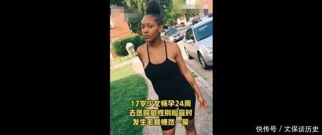 却说|毛骨悚然！孕妇做B超被吓坏，孩子突然睁眼怪笑！医生却说……