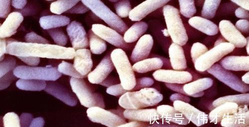 益生菌|通便产品用多了小心肠道变黑，缓解便秘补足肠道内一样东西即可