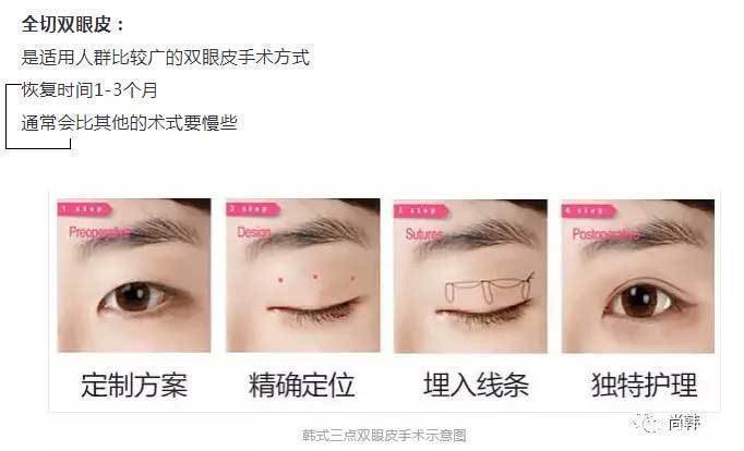 恢复|为啥割了双眼皮以后,你恢复的比别人慢