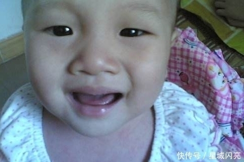 永久性|3岁男童没有一颗牙,无法吃东西,得知原因,医生大骂母亲