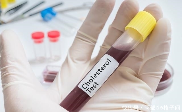 超过|血脂超过多少才算高血脂?医生提醒:有时血脂在正常范围也要干预
