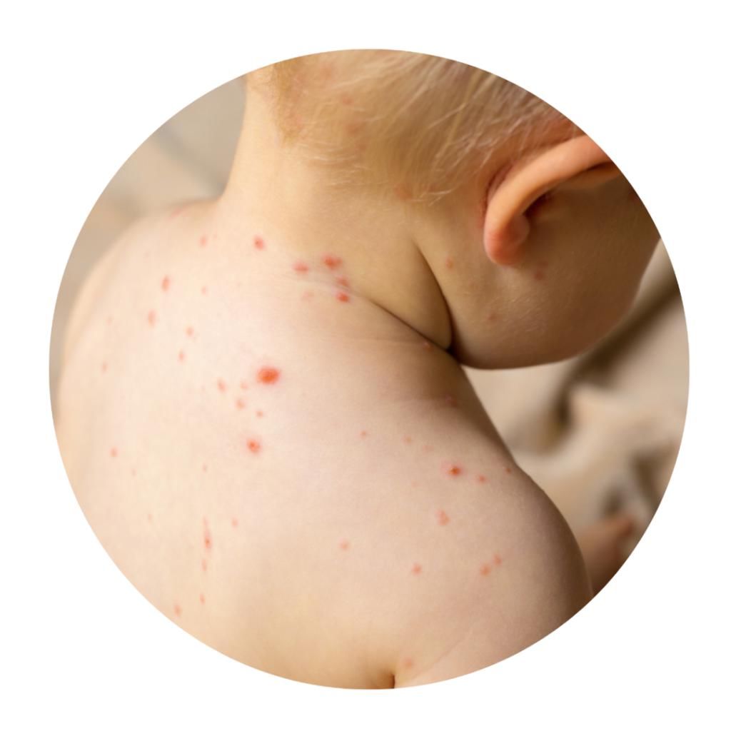 症状|求你了！有这几种情况，千万别亲宝宝！