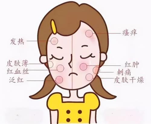 你的水乳上黑名单了吗？小心“烂脸”