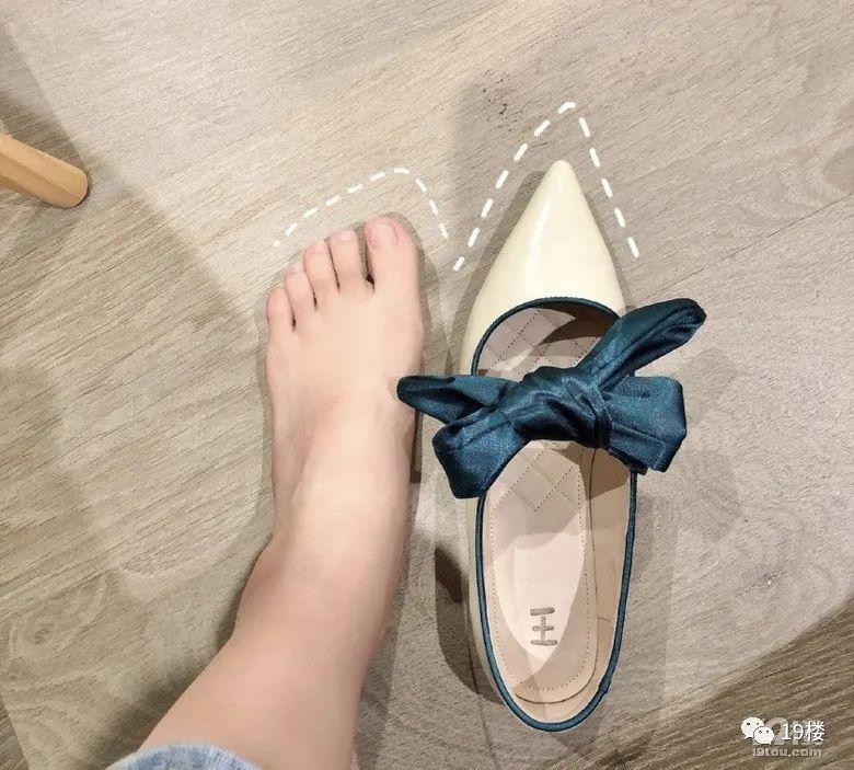扁平足|姑娘穿平底鞋,走一天路痛到不行…原来穿鞋还得看脚型?