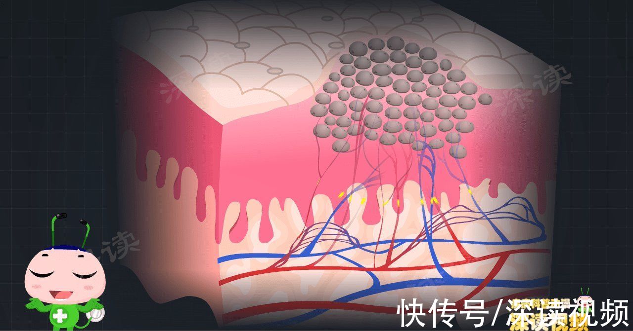 尖锐湿疣|明明没出轨，为啥染上尖锐湿疣？有哪些你不知道的事会招惹HPV？