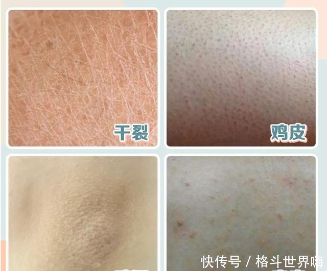 女孩|那些坚持涂身体乳的女孩,皮肤都怎么样了