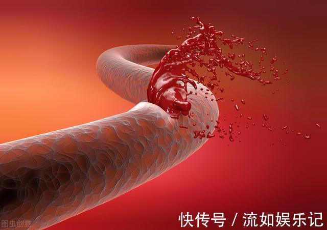 头晕头痛|53岁大妈1年脑出血3次,医生怒斥:人老了,4件事还不控制好